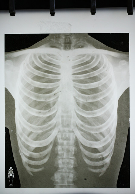 rib_cage_x_ray_20_sized.jpg